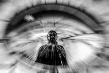 Eye